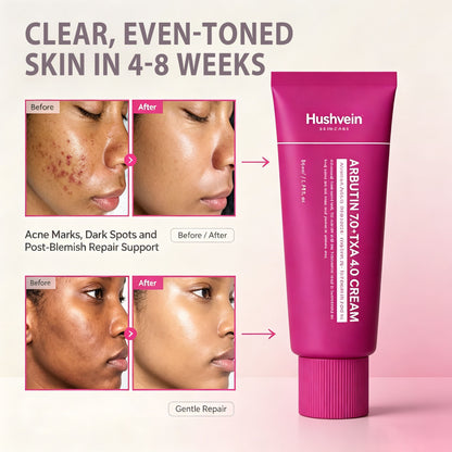 Alpha Arbutin + TXA Cream