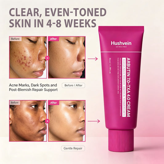 Alpha Arbutin + TXA Cream