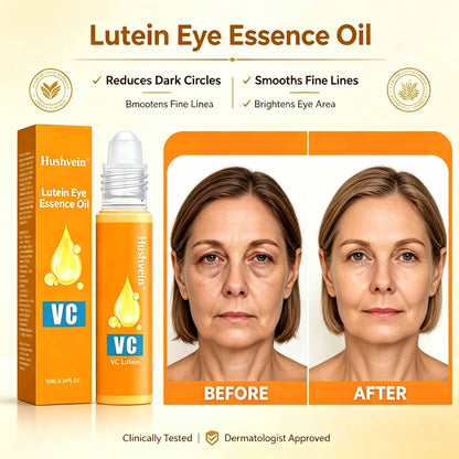 Hushvein | Say Goodbye to Heavy, Tired Eyelids