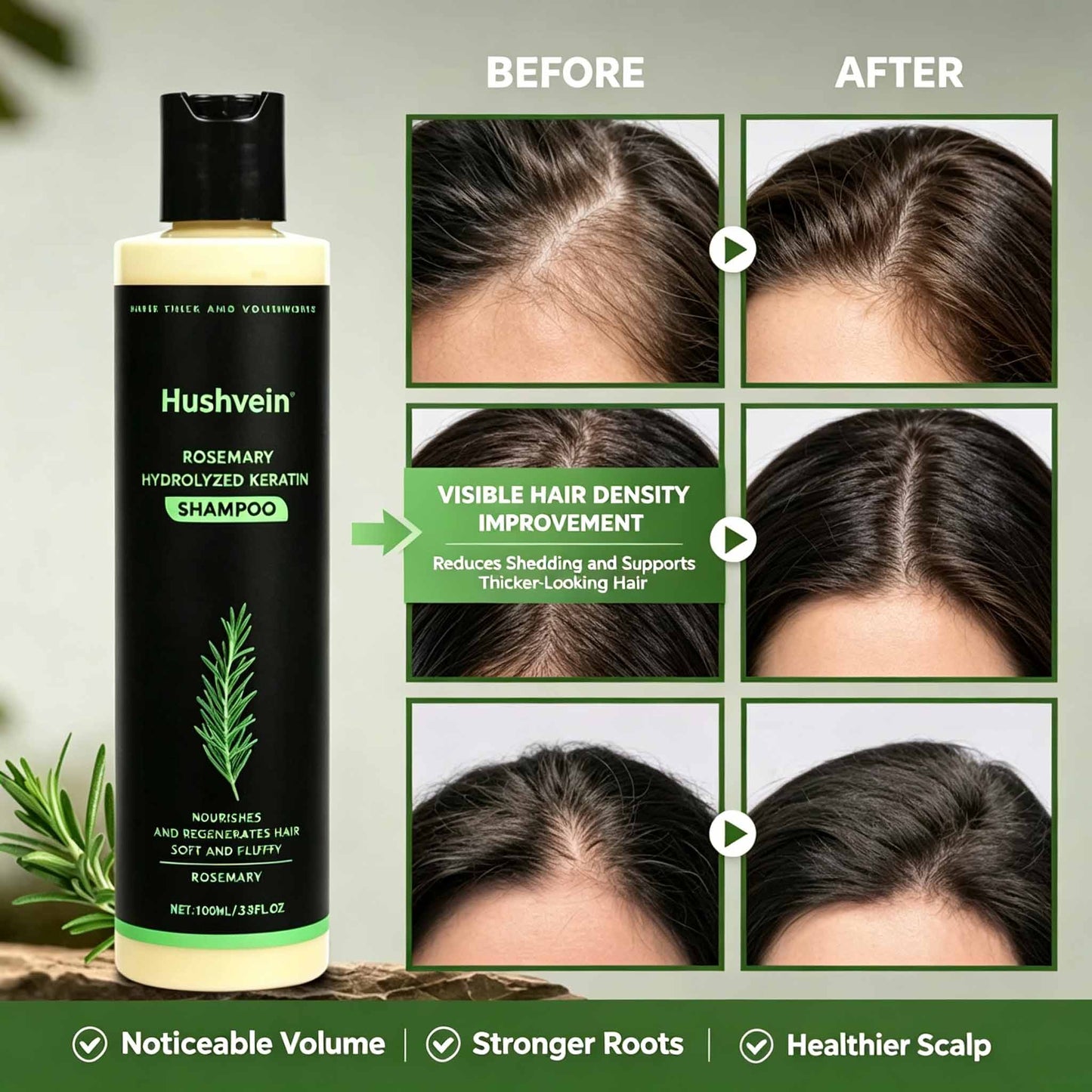 Hushvein Rosemary Shampoo for Men & Women – Clinically Proven to Reduce Thinning & Boost Growth