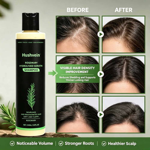 Hushvein Rosemary Shampoo for Men & Women – Clinically Proven to Reduce Thinning & Boost Growth
