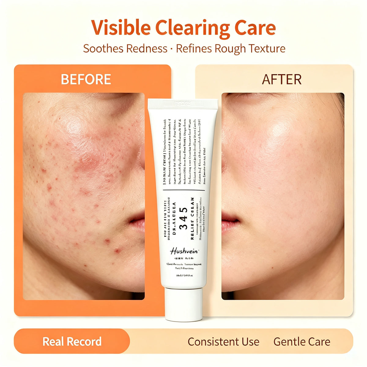 Hushvein 345 Relief Cream, 1.69 Fl Oz (Ver.2 - Pack of 1) | PDRN, Hyaluronic Acid for Instant Hydration, Blemish, Post-Acne Vegan Face Moisturizer with Centella, Non-comedogenic