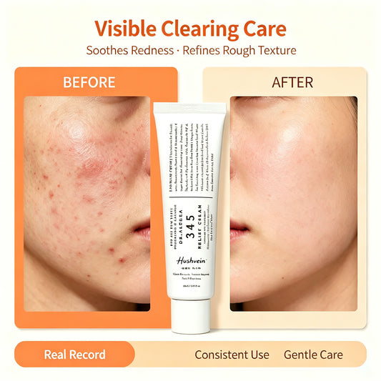 Hushvein 345 Relief Cream, 1.69 Fl Oz (Ver.2 - Pack of 1) | PDRN, Hyaluronic Acid for Instant Hydration, Blemish, Post-Acne Vegan Face Moisturizer with Centella, Non-comedogenic