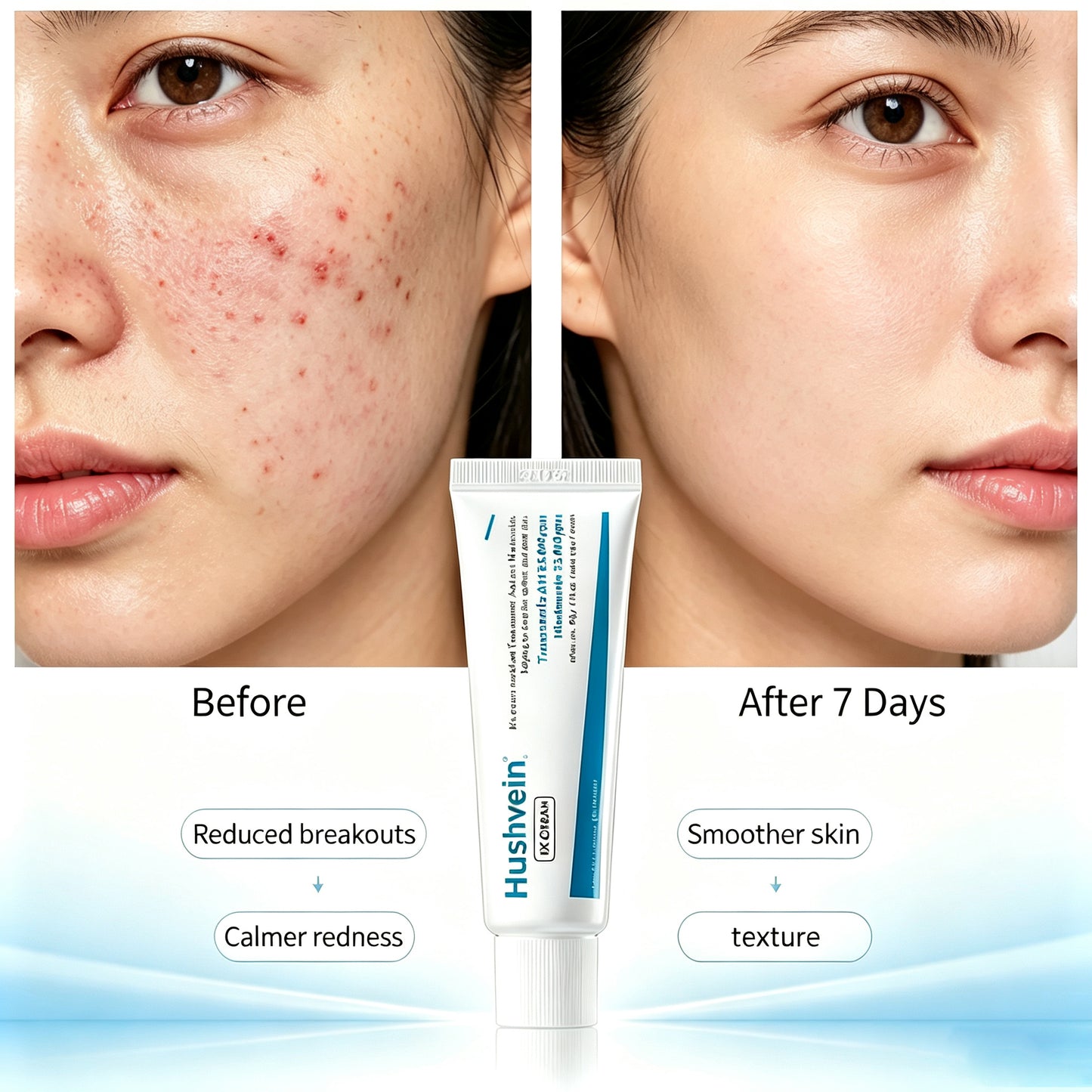 Hushvein TX Cream 50ml, Tranexamic Acid & Niacinamide Dark Spot & Hyperpigmentation Care– Fades Breakouts & Restores Skin