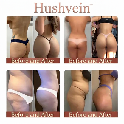 Hushvein™ CurveSculpt Micro Patch Sculpt Firm Smooth Lower Body Curves Micro-Needle Infusion System