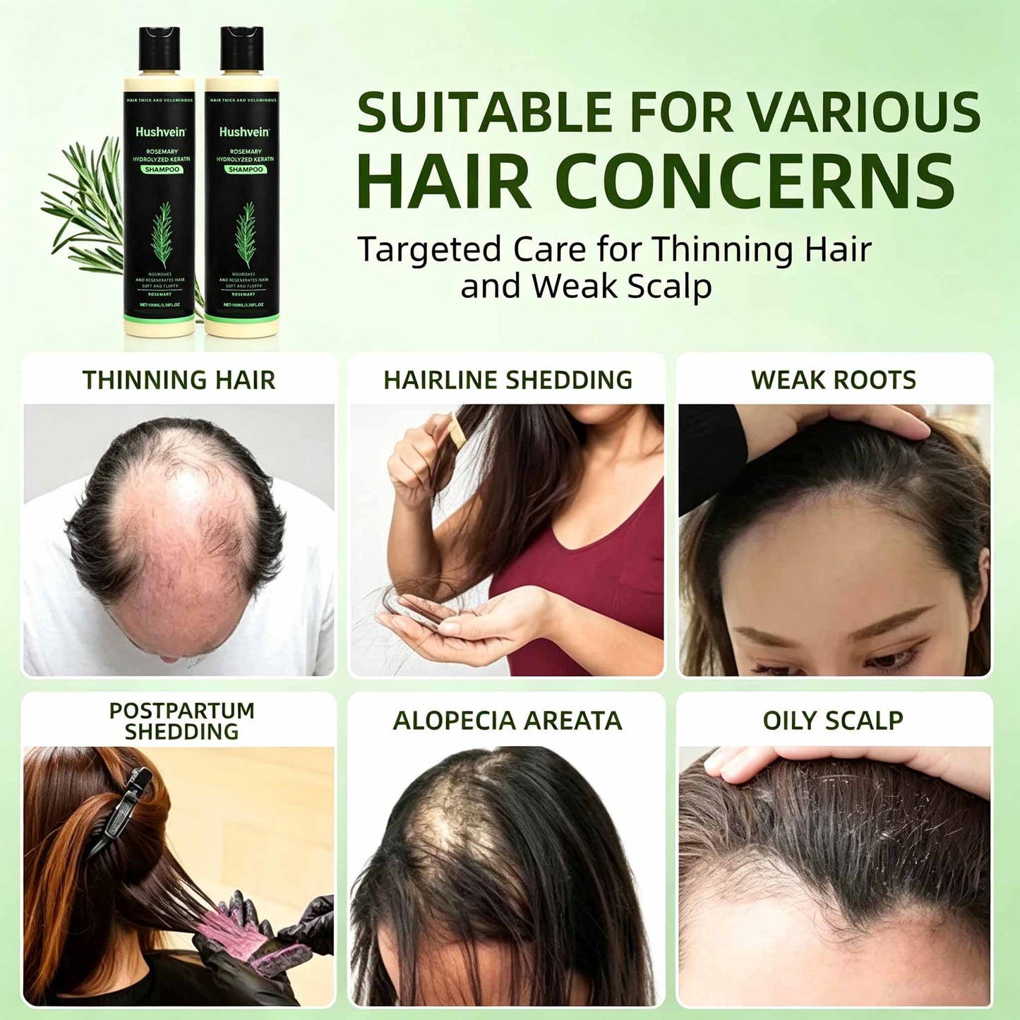 Hushvein Rosemary Shampoo for Men & Women – Clinically Proven to Reduce Thinning & Boost Growth