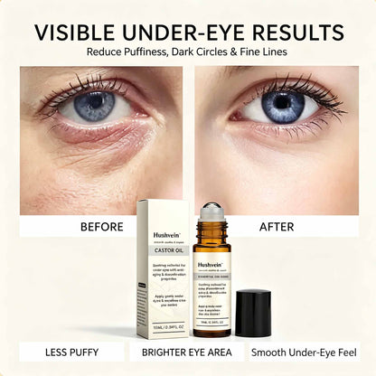 Hushvein™: The Instant Eye Lift That Doesn't Betray You When You Smile