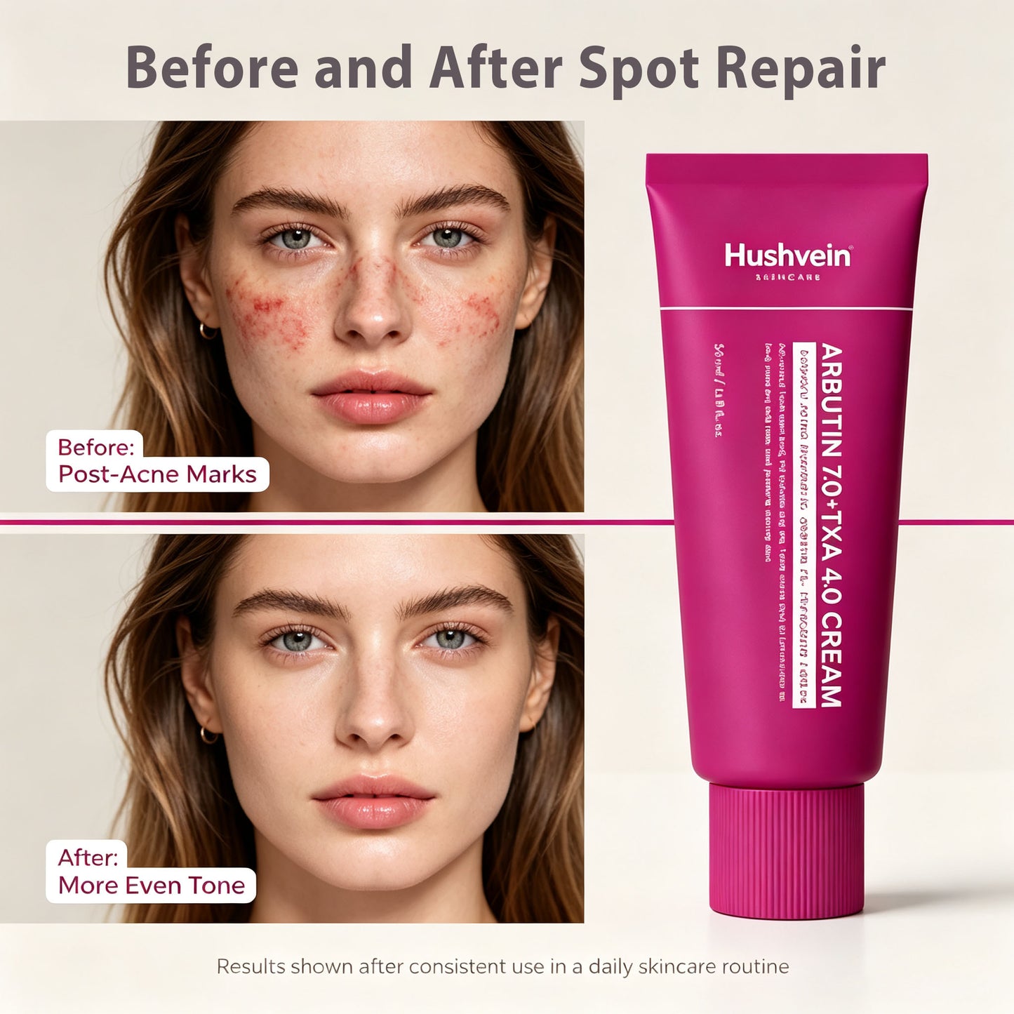 Alpha Arbutin + TXA Cream