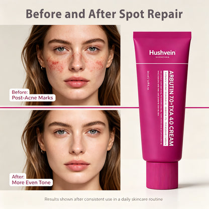 Alpha Arbutin + TXA Cream