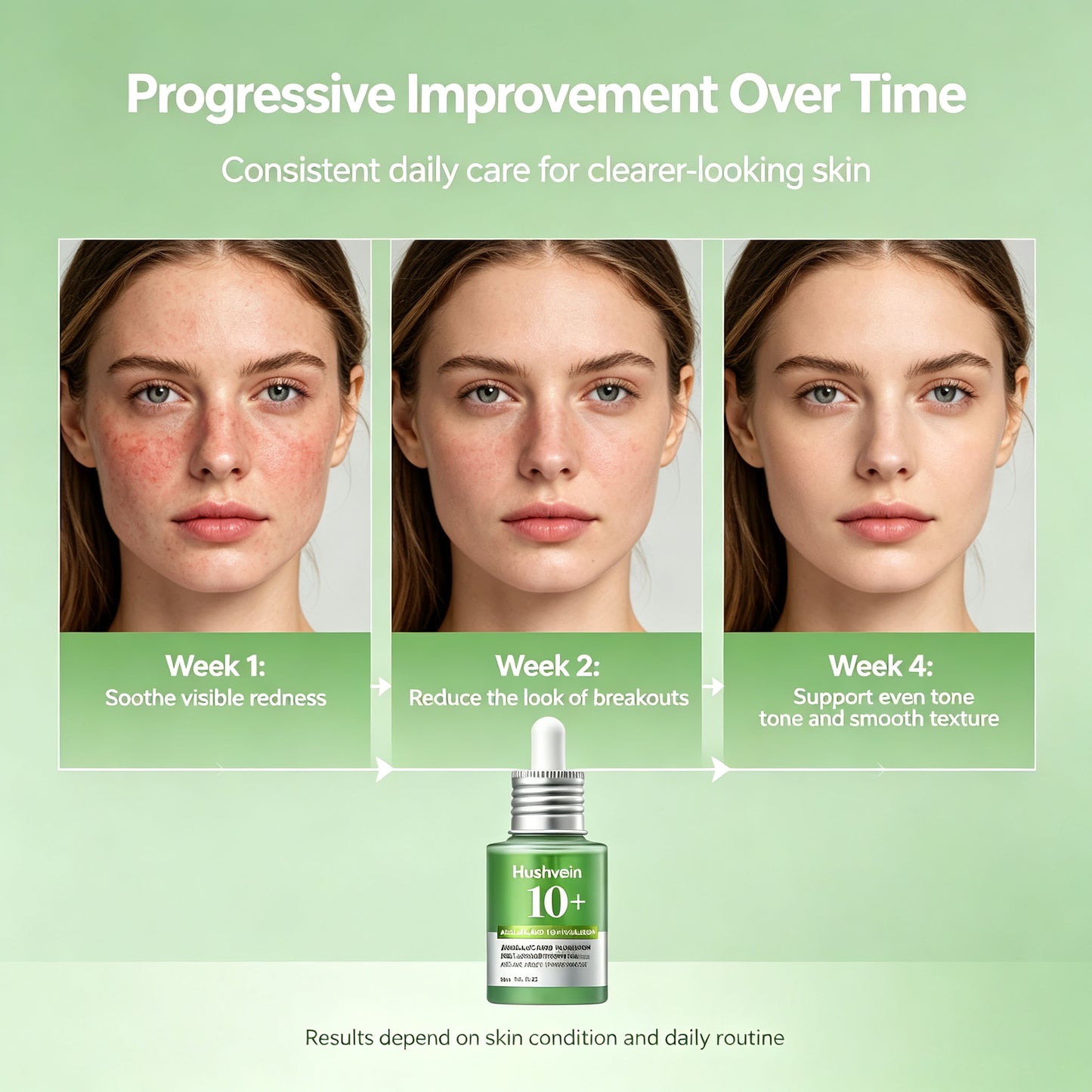 Hushvein 10% Azelaic Acid & Hyaluronic Acid Soothing & Redness-Relief Serum 30ml (1.01 fl.oz.) | Specially formulated for acne-prone and oily skin—soothes, reduces redness; suitable for sensitive and acne-prone skin