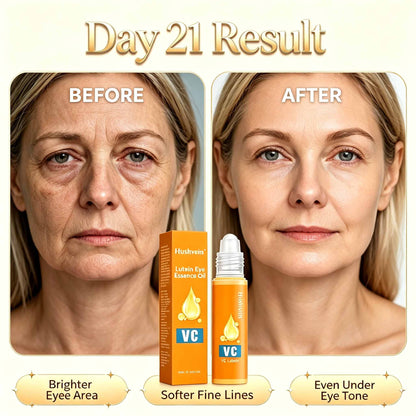 Hushvein | Say Goodbye to Heavy, Tired Eyelids