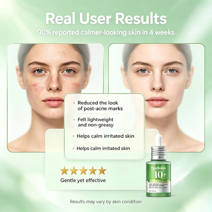 Hushvein 10% Azelaic Acid & Hyaluronic Acid Soothing & Redness-Relief Serum 30ml (1.01 fl.oz.) | Specially formulated for acne-prone and oily skin—soothes, reduces redness; suitable for sensitive and acne-prone skin