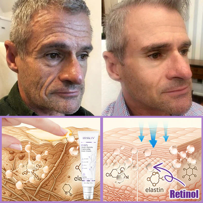 Hushvein Multi-Peptide Massaging Body Roller Cream- Anti-aging, Hydrating, Skin Firming & Lifting, Skin Repair, Even Tone, Acne and Dark Spot Treatment, Wart and Mole Removal, and Psoriasis Relief.