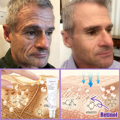 Hushvein Multi-Peptide Massaging Body Roller Cream- Anti-aging, Hydrating, Skin Firming & Lifting, Skin Repair, Even Tone, Acne and Dark Spot Treatment, Wart and Mole Removal, and Psoriasis Relief.