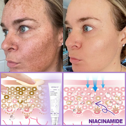 Hushvein Multi-Peptide Massaging Body Roller Cream- Anti-aging, Hydrating, Skin Firming & Lifting, Skin Repair, Even Tone, Acne and Dark Spot Treatment, Wart and Mole Removal, and Psoriasis Relief.