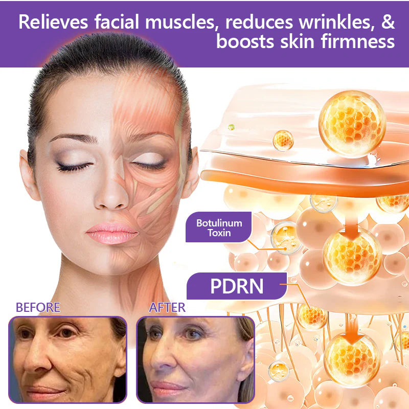 Hushvein Multi-Peptide Massaging Body Roller Cream- Anti-aging, Hydrating, Skin Firming & Lifting, Skin Repair, Even Tone, Acne and Dark Spot Treatment, Wart and Mole Removal, and Psoriasis Relief.