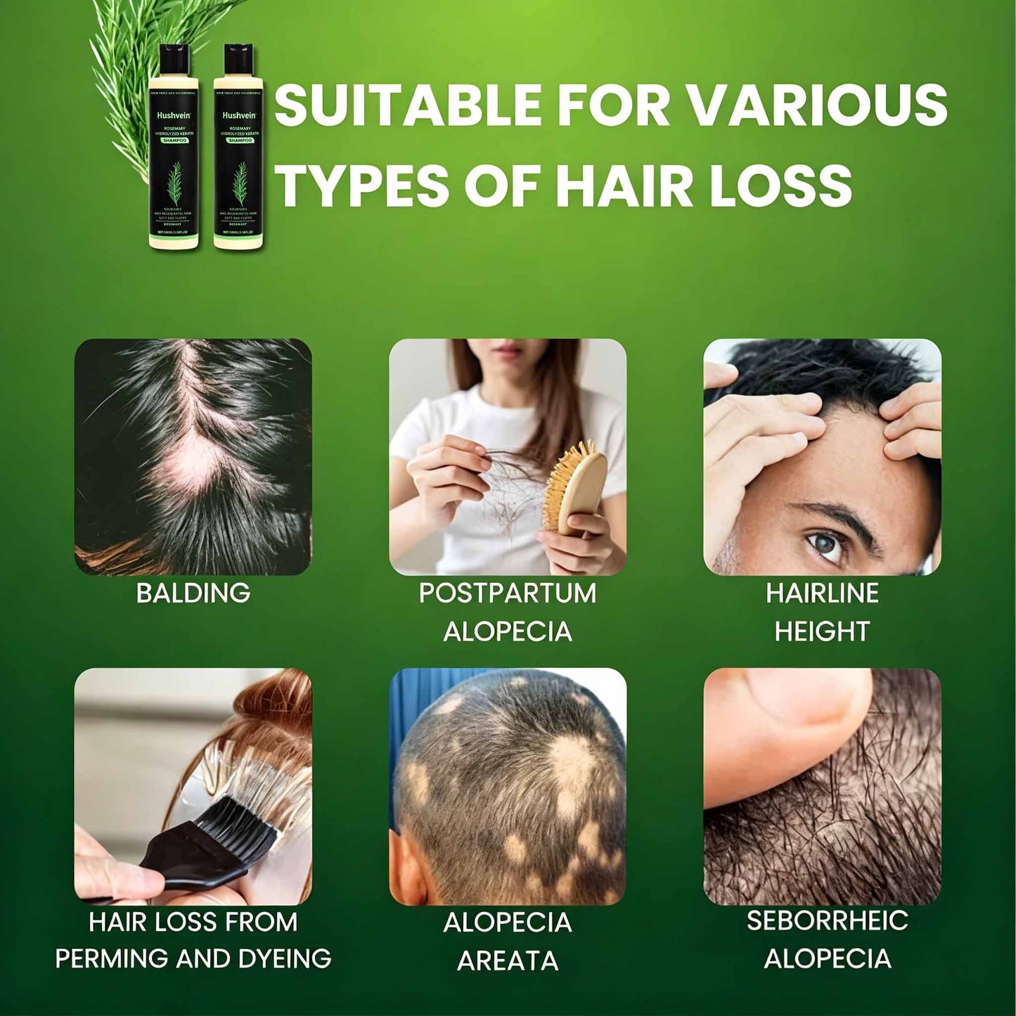 Hushvein Rosemary Shampoo for Men & Women – Clinically Proven to Reduce Thinning & Boost Growth