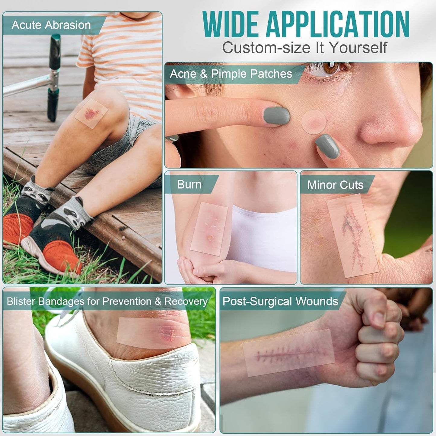 Hushvein Medical-Grade Hydrocolloid Dressing Roll – Highly absorbent and waterproof; suitable for treating burns, blisters, and acne; a first-aid kit essential.
