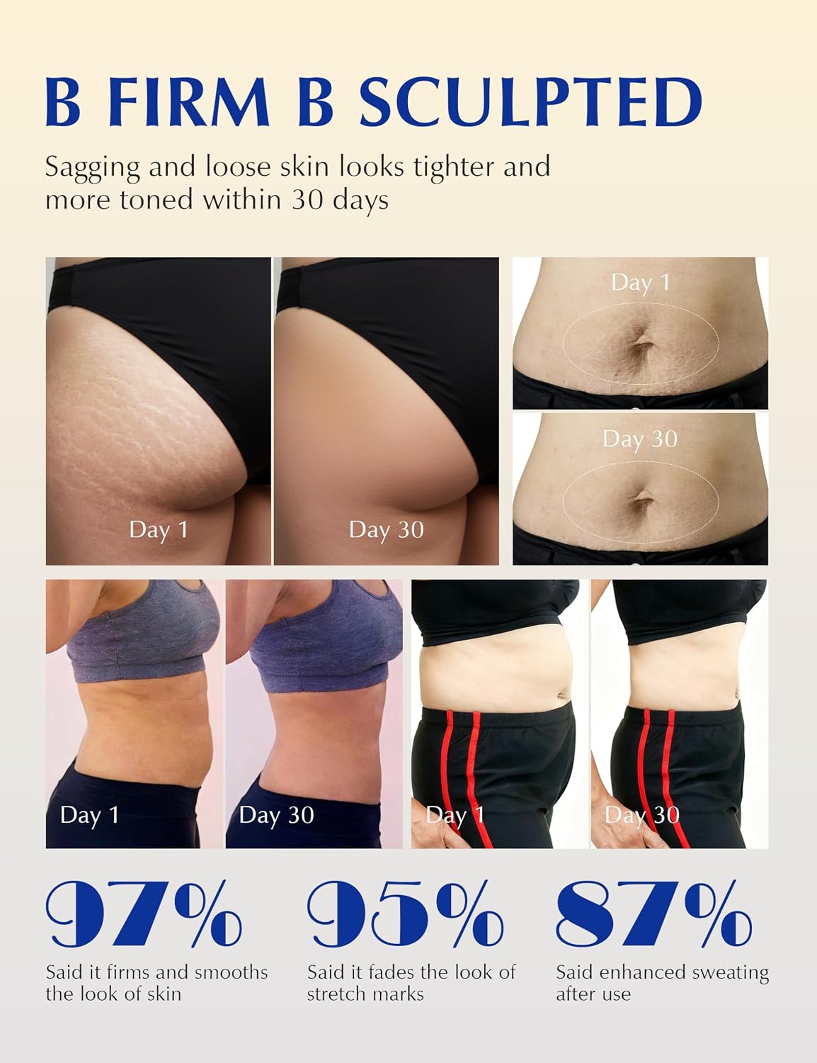 Hushvein Tightening Burn Gold Massage Cream& 15-Day Fast-Acting Anti Cellulite Sculpting | Cryo Thermo cellulite remover for legs ,Belly & Arm| WELLENESS，Refreshing Formula | Unisex Body Contouring Treatment for Men & Women |200 G