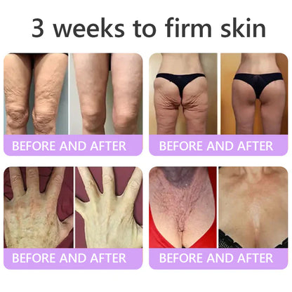 Hushvein Multi-Peptide Massaging Body Roller Cream- Anti-aging, Hydrating, Skin Firming & Lifting, Skin Repair, Even Tone, Acne and Dark Spot Treatment, Wart and Mole Removal, and Psoriasis Relief.