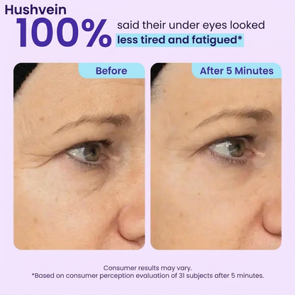 Hushvein Eye Bag Instant Eraser, Tightens, Firms, & Blurs Wrinkles