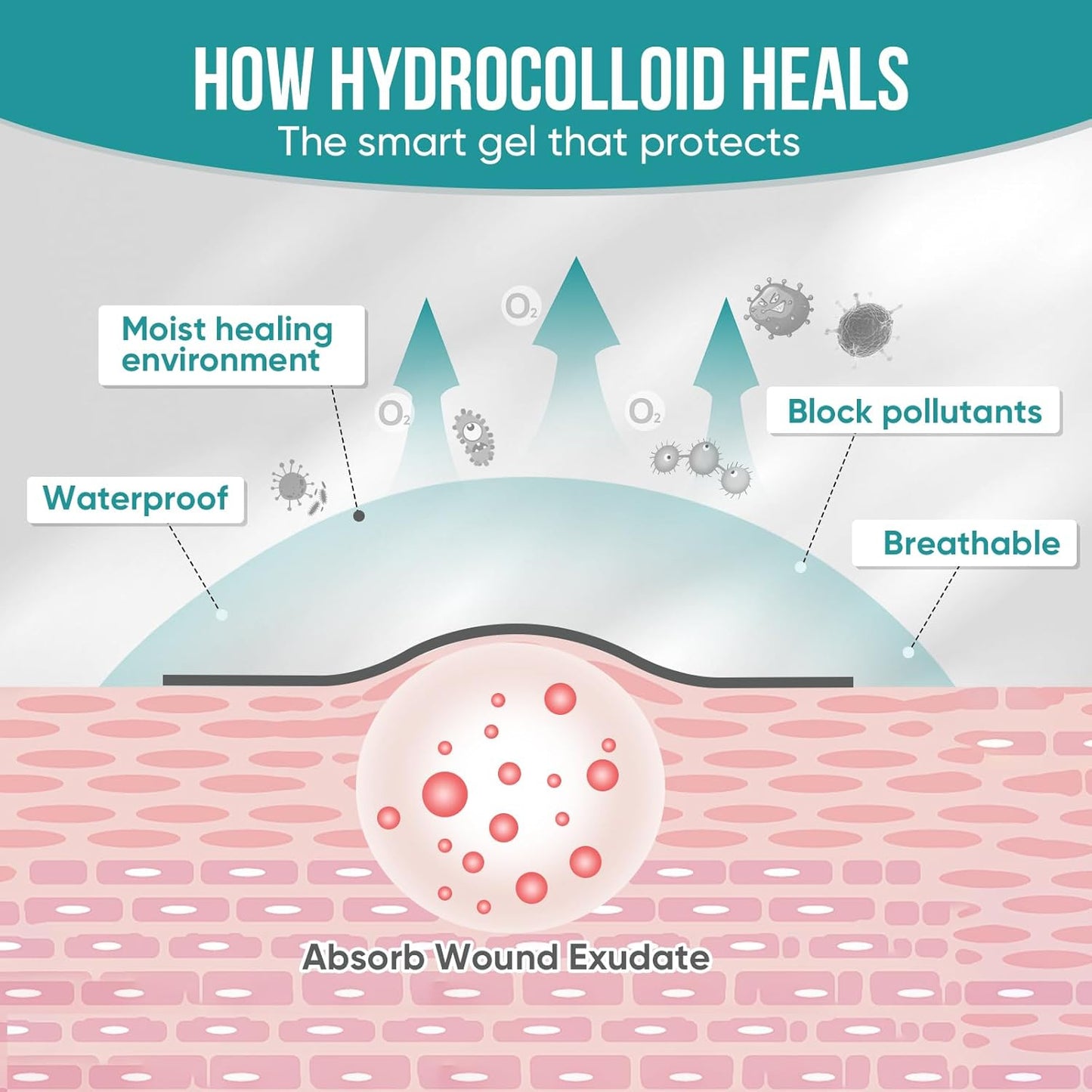 Hushvein Medical-Grade Hydrocolloid Dressing Roll – Highly absorbent and waterproof; suitable for treating burns, blisters, and acne; a first-aid kit essential.