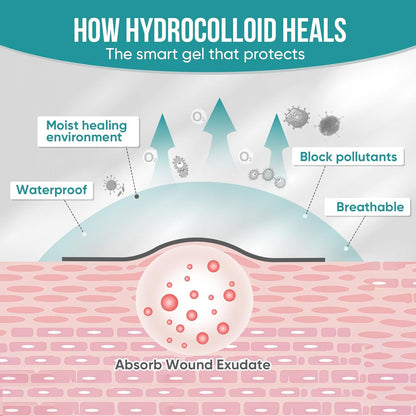 Hushvein Medical-Grade Hydrocolloid Dressing Roll – Highly absorbent and waterproof; suitable for treating burns, blisters, and acne; a first-aid kit essential.