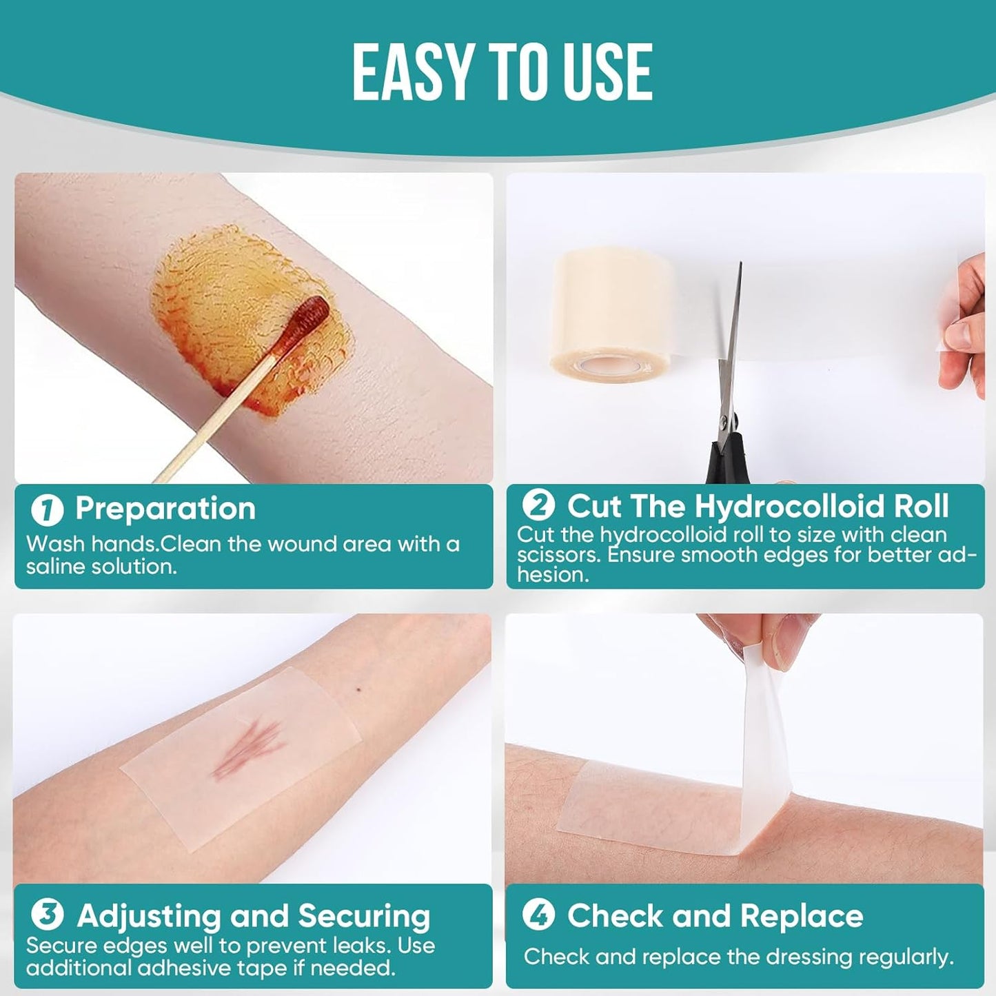 Hushvein Medical-Grade Hydrocolloid Dressing Roll – Highly absorbent and waterproof; suitable for treating burns, blisters, and acne; a first-aid kit essential.