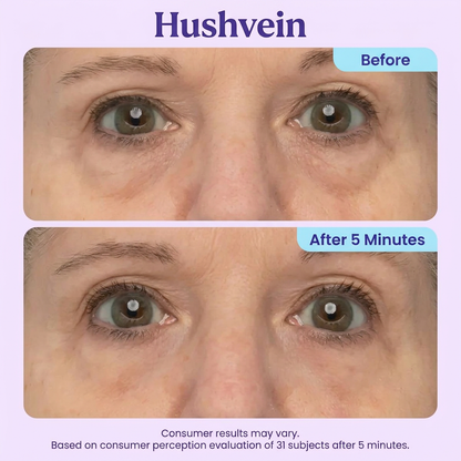 Hushvein Eye Bag Instant Eraser, Tightens, Firms, & Blurs Wrinkles