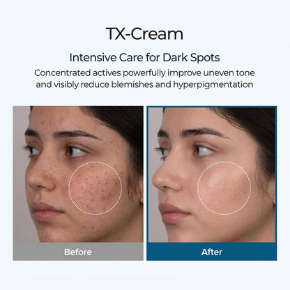 Hushvein TX Cream 50ml, Tranexamic Acid & Niacinamide Dark Spot & Hyperpigmentation Care– Fades Breakouts & Restores Skin