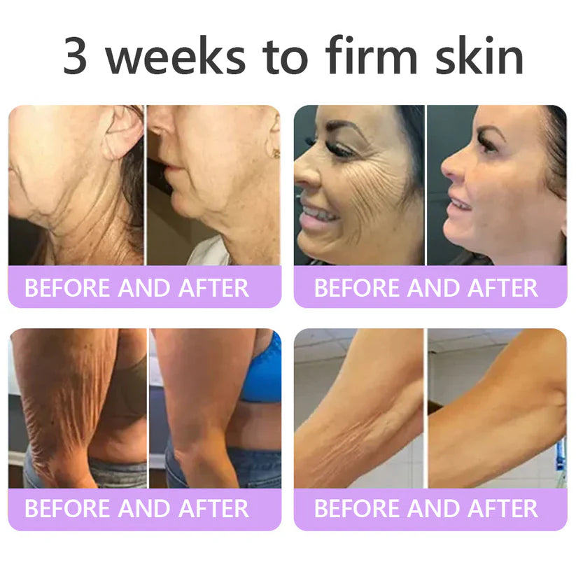 Hushvein Multi-Peptide Massaging Body Roller Cream- Anti-aging, Hydrating, Skin Firming & Lifting, Skin Repair, Even Tone, Acne and Dark Spot Treatment, Wart and Mole Removal, and Psoriasis Relief.