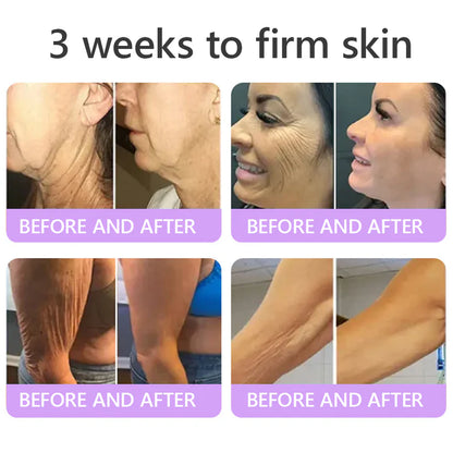 Hushvein Multi-Peptide Massaging Body Roller Cream- Anti-aging, Hydrating, Skin Firming & Lifting, Skin Repair, Even Tone, Acne and Dark Spot Treatment, Wart and Mole Removal, and Psoriasis Relief.