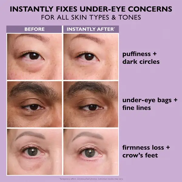 Hushvein Eye Bag Instant Eraser, Tightens, Firms, & Blurs Wrinkles