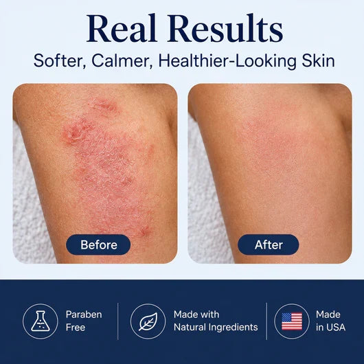 HUSHVEIN™ Intensive Sea Moss Soothing Cream