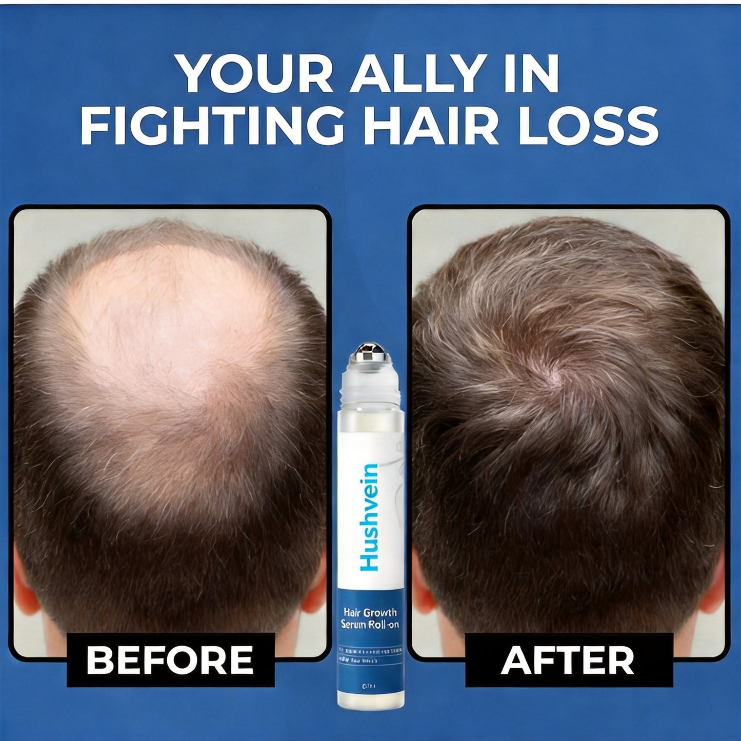 Hushvein Hair Growth Rollon Serum
