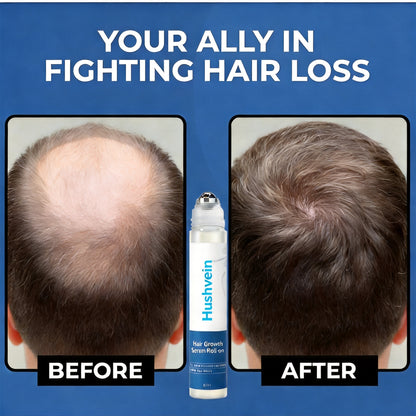 Hushvein Hair Growth Rollon Serum