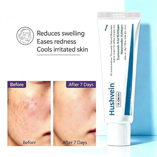 Hushvein TX Cream 50ml, Tranexamic Acid & Niacinamide Dark Spot & Hyperpigmentation Care– Fades Breakouts & Restores Skin